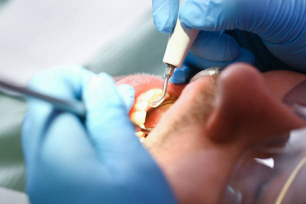 Best Emergency Dental Care for Broken or Chipped Teeth in Shallowater, TX