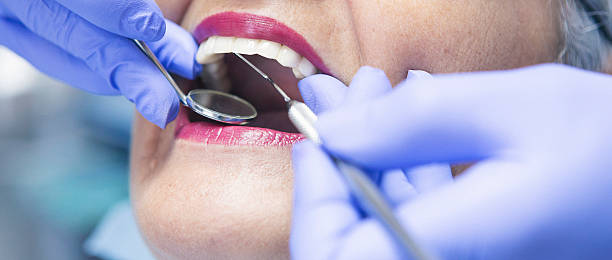 Best Emergency Treatment for Dental Infections or Abscesses in Shallowater, TX